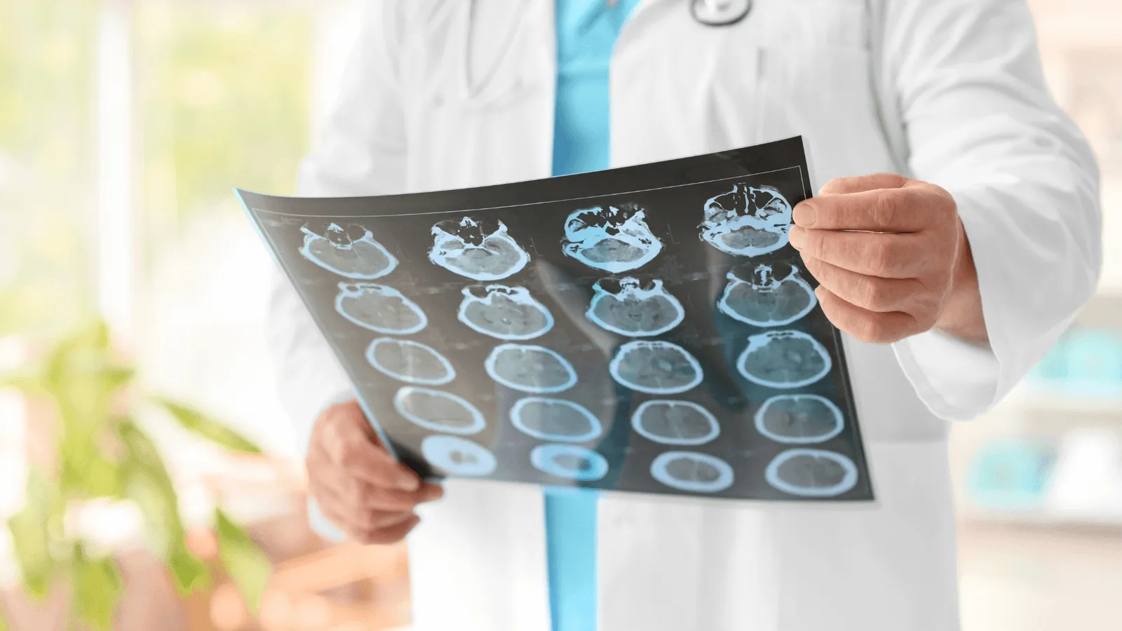 Momentum par BioSked aux JFR 2024 : Réinventez la gestion de vos plannings en radiologie